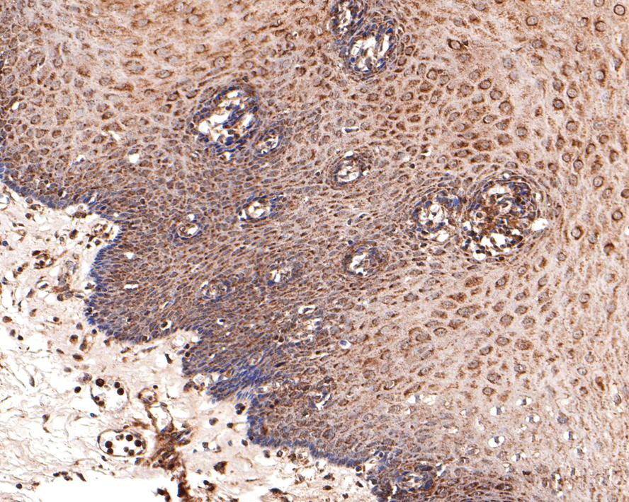 Immunohistochemical analysis of paraffin-embedded mouse colon tissue using anti-IL17A antibody. The section was pre-treated using heat mediated antigen retrieval with Tris-EDTA buffer (pH 8.0-8.4) for 20 minutes.The tissues were blocked in 5% BSA for 30 minutes at room temperature, washed with ddH2O and PBS, and then probed with the primary antibody (ER1902-37, 1/100) for 30 minutes at room temperature. The detection was performed using an HRP conjugated compact polymer system. DAB was used as the chromogen. Tissues were counterstained with hematoxylin and mounted with DPX.