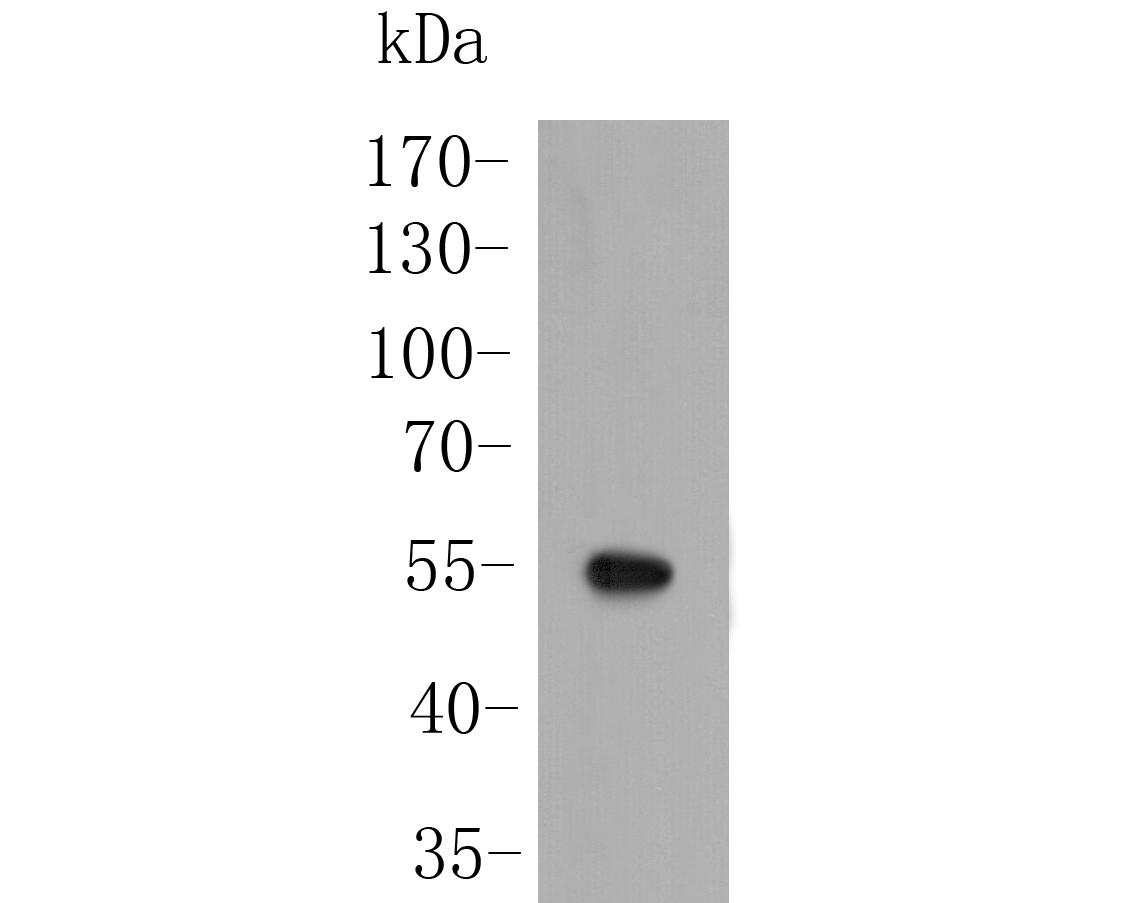 Western blot analysis of SARS2 on Zebrafish tissue lysate. Proteins were transferred to a PVDF membrane and blocked with 5% BSA in PBS for 1 hour at room temperature. The primary antibody (ER1902-38, 1/500) was used in 5% BSA at room temperature for 2 hours. Goat Anti-Rabbit IgG - HRP Secondary Antibody (HA1001) at 1:5,000 dilution was used for 1 hour at room temperature.