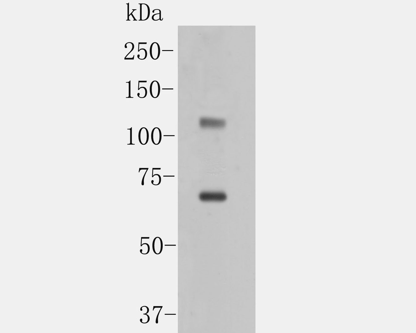 Western blot analysis of ACE2 on human kidney tissue lysate. Proteins were transferred to a PVDF membrane and blocked with 5% BSA in PBS for 1 hour at room temperature. The primary antibody (ER1902-40, 1/500) was used in 5% BSA at room temperature for 2 hours. Goat Anti-Rabbit IgG - HRP Secondary Antibody (HA1001) at 1:5,000 dilution was used for 1 hour at room temperature.