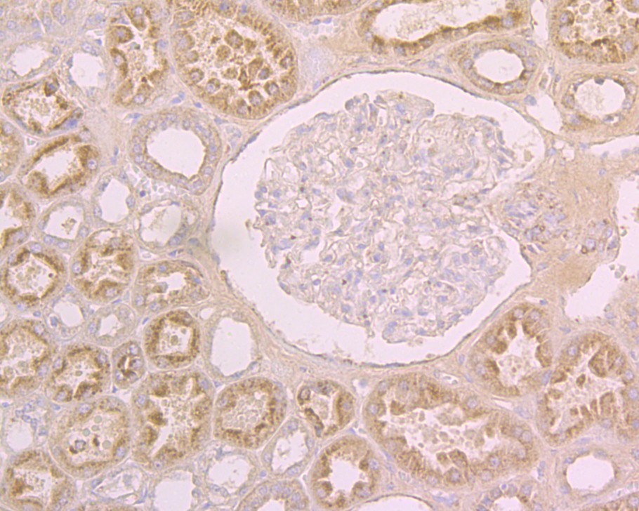 Immunohistochemical analysis of paraffin-embedded human kidney tissue using anti-ACE2 antibody. The section was pre-treated using heat mediated antigen retrieval with Tris-EDTA buffer (pH 8.0-8.4) for 20 minutes.The tissues were blocked in 5% BSA for 30 minutes at room temperature, washed with ddH2O and PBS, and then probed with the primary antibody (ER1902-40, 1/200) for 30 minutes at room temperature. The detection was performed using an HRP conjugated compact polymer system. DAB was used as the chromogen. Tissues were counterstained with hematoxylin and mounted with DPX.