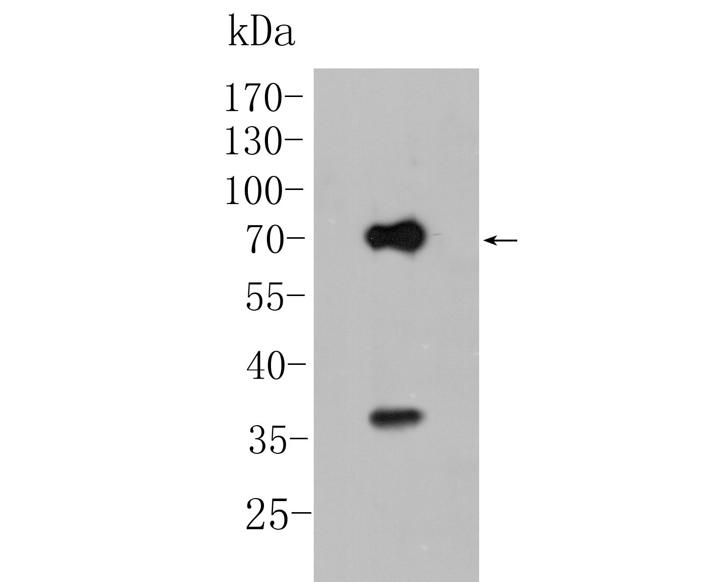 Western blot analysis of KCNN2 on rat brain tissue lysate. Proteins were transferred to a PVDF membrane and blocked with 5% BSA in PBS for 1 hour at room temperature. The primary antibody (ER1902-41, 1/500) was used in 5% BSA at room temperature for 2 hours. Goat Anti-Rabbit IgG - HRP Secondary Antibody (HA1001) at 1:5,000 dilution was used for 1 hour at room temperature.