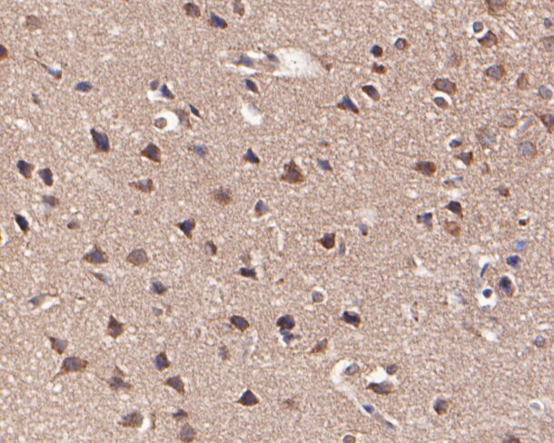 Immunohistochemical analysis of paraffin-embedded rat brain tissue using anti-KCNN2 antibody. The section was pre-treated using heat mediated antigen retrieval with Tris-EDTA buffer (pH 8.0-8.4) for 20 minutes.The tissues were blocked in 5% BSA for 30 minutes at room temperature, washed with ddH2O and PBS, and then probed with the primary antibody (ER1902-41, 1/100) for 30 minutes at room temperature. The detection was performed using an HRP conjugated compact polymer system. DAB was used as the chromogen. Tissues were counterstained with hematoxylin and mounted with DPX.