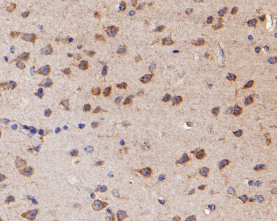 Immunohistochemical analysis of paraffin-embedded mouse brain tissue using anti-KCNN2 antibody. The section was pre-treated using heat mediated antigen retrieval with Tris-EDTA buffer (pH 8.0-8.4) for 20 minutes.The tissues were blocked in 5% BSA for 30 minutes at room temperature, washed with ddH2O and PBS, and then probed with the primary antibody (ER1902-41, 1/100) for 30 minutes at room temperature. The detection was performed using an HRP conjugated compact polymer system. DAB was used as the chromogen. Tissues were counterstained with hematoxylin and mounted with DPX.