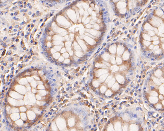 Immunohistochemical analysis of paraffin-embedded human colon tissue using anti-KCNN2 antibody. The section was pre-treated using heat mediated antigen retrieval with Tris-EDTA buffer (pH 8.0-8.4) for 20 minutes.The tissues were blocked in 5% BSA for 30 minutes at room temperature, washed with ddH2O and PBS, and then probed with the primary antibody (ER1902-41, 1/100) for 30 minutes at room temperature. The detection was performed using an HRP conjugated compact polymer system. DAB was used as the chromogen. Tissues were counterstained with hematoxylin and mounted with DPX.