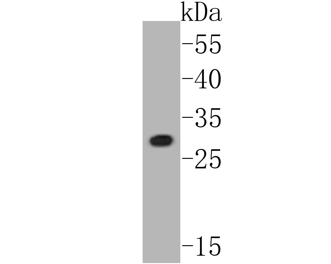 Western blot analysis of Connexin-26 on human skin tissue lysates. Proteins were transferred to a PVDF membrane and blocked with 5% BSA in PBS for 1 hour at room temperature. The primary antibody (ER1902-42, 1/500) was used in 5% BSA at room temperature for 2 hours. Goat Anti-Rabbit IgG - HRP Secondary Antibody (HA1001) at 1:5,000 dilution was used for 1 hour at room temperature.