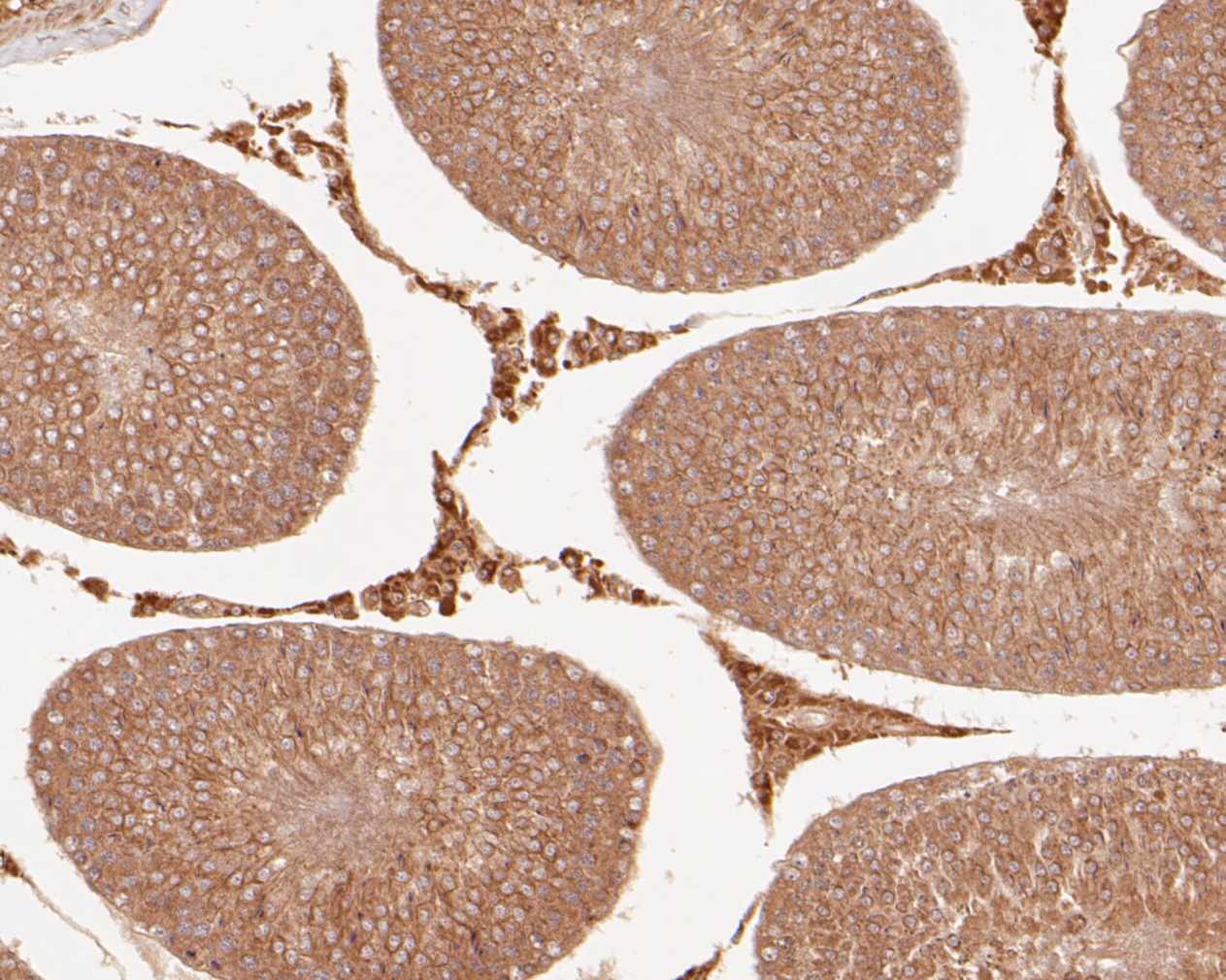 Immunohistochemical analysis of paraffin-embedded rat testis tissue using anti-Connexin-26 antibody. The section was pre-treated using heat mediated antigen retrieval with Tris-EDTA buffer (pH 8.0-8.4) for 20 minutes.The tissues were blocked in 5% BSA for 30 minutes at room temperature, washed with ddH2O and PBS, and then probed with the primary antibody (ER1902-42, 1/50) for 30 minutes at room temperature. The detection was performed using an HRP conjugated compact polymer system. DAB was used as the chromogen. Tissues were counterstained with hematoxylin and mounted with DPX.