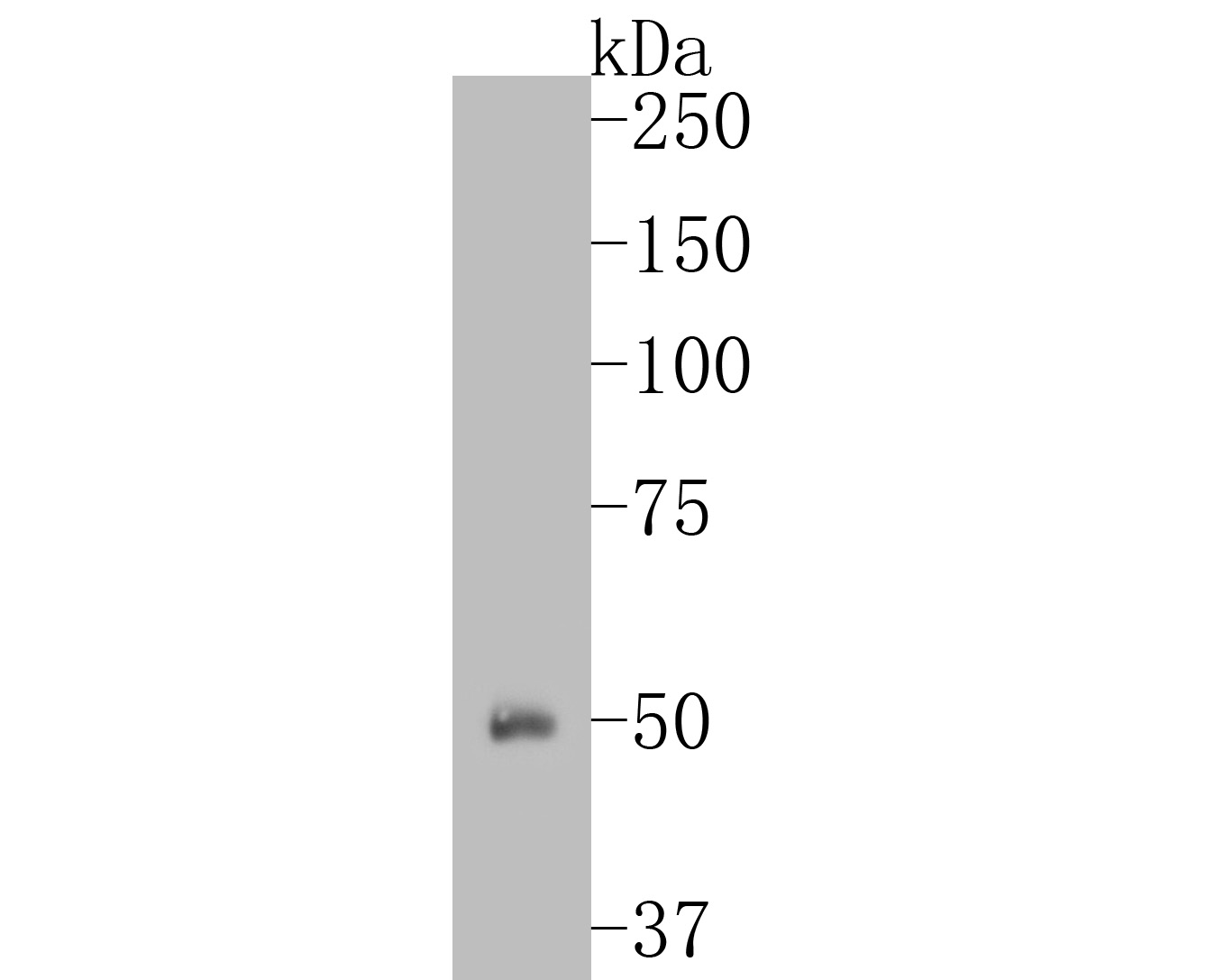 Western blot analysis of ETN1 on human plasma lysates. Proteins were transferred to a PVDF membrane and blocked with 5% BSA in PBS for 1 hour at room temperature. The primary antibody (ER1902-43, 1/1,000) was used in 5% BSA at room temperature for 2 hours. Goat Anti-Rabbit IgG - HRP Secondary Antibody (HA1001) at 1:5,000 dilution was used for 1 hour at room temperature.