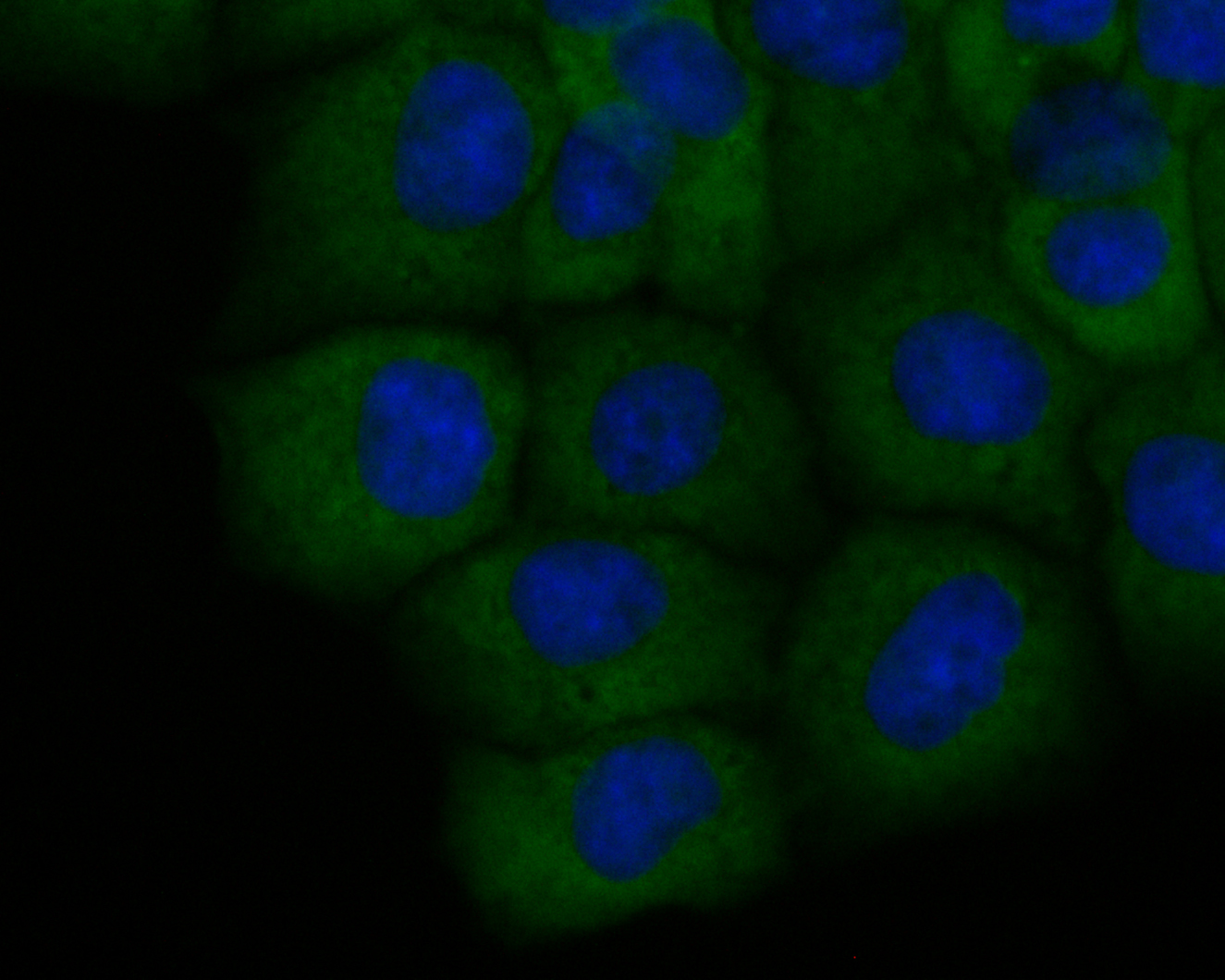 ICC staining of ETN1 in JAR cells (green). Formalin fixed cells were permeabilized with 0.1% Triton X-100 in TBS for 10 minutes at room temperature and blocked with 1% Blocker BSA for 15 minutes at room temperature. Cells were probed with the primary antibody (ER1902-43, 1/50) for 1 hour at room temperature, washed with PBS. Alexa Fluor®488 Goat anti-Rabbit IgG was used as the secondary antibody at 1/1,000 dilution. The nuclear counter stain is DAPI (blue).