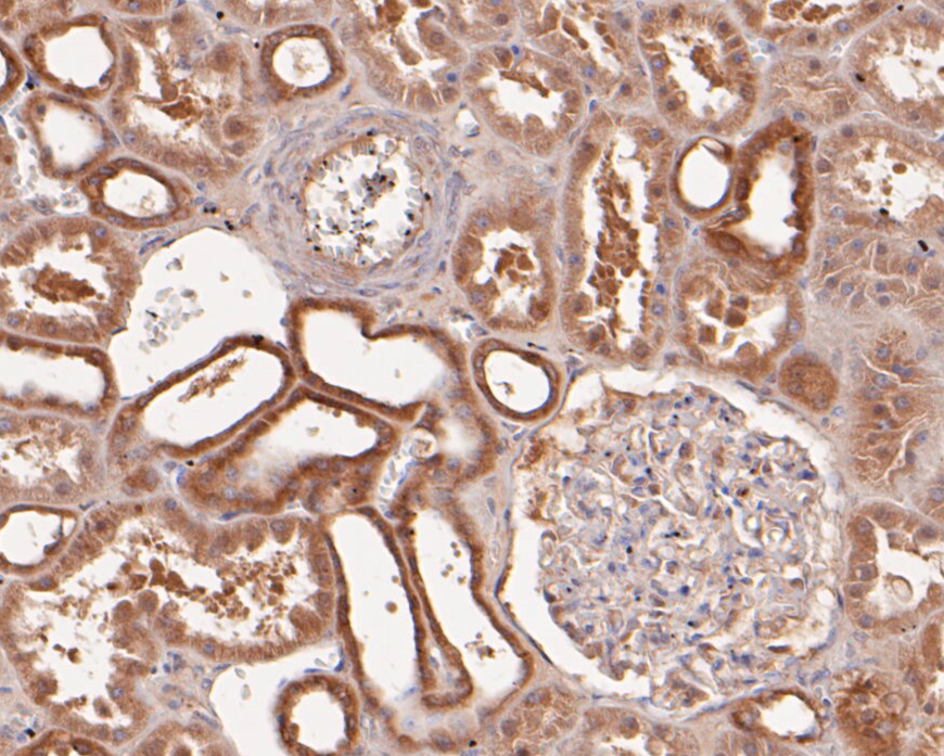 Immunohistochemical analysis of paraffin-embedded human kidney tissue using anti-ETN1 antibody. The section was pre-treated using heat mediated antigen retrieval with Tris-EDTA buffer (pH 8.0-8.4) for 20 minutes.The tissues were blocked in 5% BSA for 30 minutes at room temperature, washed with ddH2O and PBS, and then probed with the primary antibody (ER1902-43, 1/50) for 30 minutes at room temperature. The detection was performed using an HRP conjugated compact polymer system. DAB was used as the chromogen. Tissues were counterstained with hematoxylin and mounted with DPX.