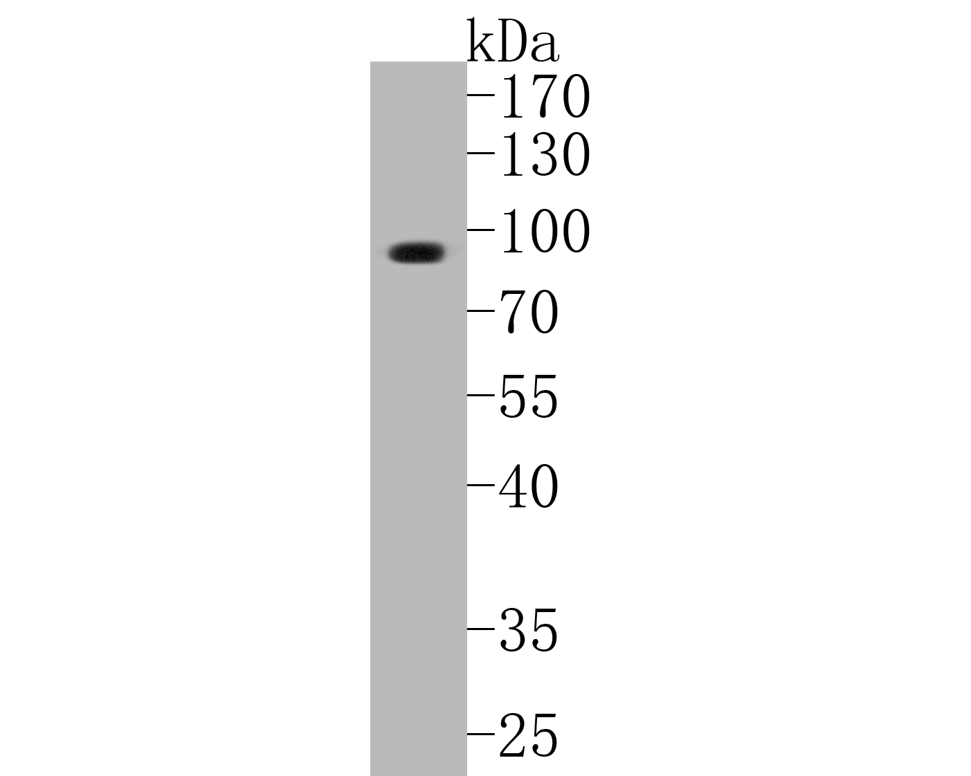 Western blot analysis of KCNK9 on rat cerebellum tissue lysates. Proteins were transferred to a PVDF membrane and blocked with 5% BSA in PBS for 1 hour at room temperature. The primary antibody (ER1902-47, 1/500) was used in 5% BSA at room temperature for 2 hours. Goat Anti-Rabbit IgG - HRP Secondary Antibody (HA1001) at 1:5,000 dilution was used for 1 hour at room temperature.