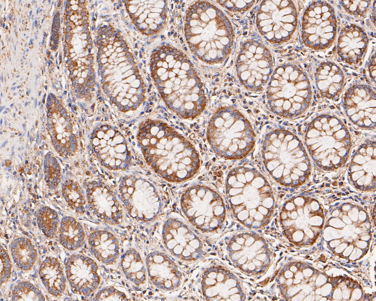 Immunohistochemical analysis of paraffin-embedded human colon tissue using anti-KCNK9 antibody. The section was pre-treated using heat mediated antigen retrieval with Tris-EDTA buffer (pH 8.0-8.4) for 20 minutes.The tissues were blocked in 5% BSA for 30 minutes at room temperature, washed with ddH2O and PBS, and then probed with the primary antibody (ER1902-47, 1/50) for 30 minutes at room temperature. The detection was performed using an HRP conjugated compact polymer system. DAB was used as the chromogen. Tissues were counterstained with hematoxylin and mounted with DPX.