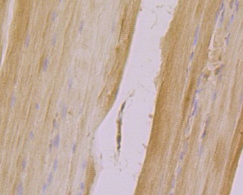 Immunohistochemical analysis of paraffin-embedded  rat skeletal muscle tissue using anti-CLIC4 antibody. The section was pre-treated using heat mediated antigen retrieval with Tris-EDTA buffer (pH 8.0-8.4) for 20 minutes.The tissues were blocked in 5% BSA for 30 minutes at room temperature, washed with ddH2O and PBS, and then probed with the primary antibody (ER1902-48, 1/100) for 30 minutes at room temperature. The detection was performed using an HRP conjugated compact polymer system. DAB was used as the chromogen. Tissues were counterstained with hematoxylin and mounted with DPX.