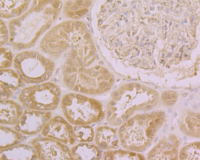 Immunohistochemical analysis of paraffin-embedded human kidney tissue using anti-CLIC4 antibody. The section was pre-treated using heat mediated antigen retrieval with Tris-EDTA buffer (pH 8.0-8.4) for 20 minutes.The tissues were blocked in 5% BSA for 30 minutes at room temperature, washed with ddH2O and PBS, and then probed with the primary antibody (ER1902-48, 1/100) for 30 minutes at room temperature. The detection was performed using an HRP conjugated compact polymer system. DAB was used as the chromogen. Tissues were counterstained with hematoxylin and mounted with DPX.