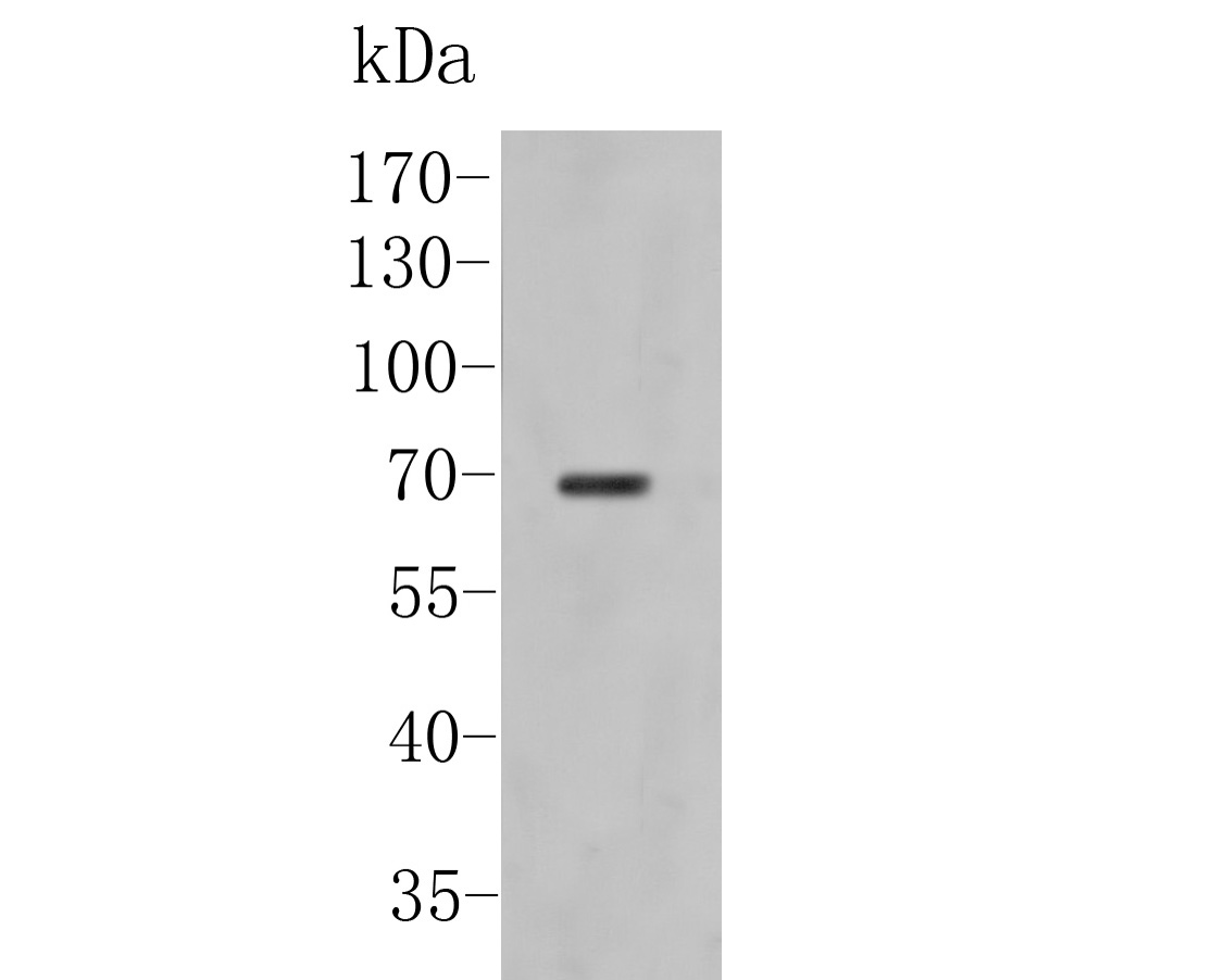 Western blot analysis of Kv1.4 on rat brain tissuet lysates. Proteins were transferred to a PVDF membrane and blocked with 5% BSA in PBS for 1 hour at room temperature. The primary antibody (ER1902-49, 1/500) was used in 5% BSA at room temperature for 2 hours. Goat Anti-Rabbit IgG - HRP Secondary Antibody (HA1001) at 1:5,000 dilution was used for 1 hour at room temperature.