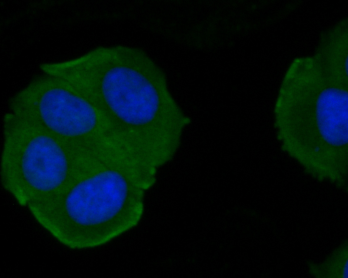 ICC staining of Kv1.4 in MCF-7 cells (green). Formalin fixed cells were permeabilized with 0.1% Triton X-100 in TBS for 10 minutes at room temperature and blocked with 1% Blocker BSA for 15 minutes at room temperature. Cells were probed with the primary antibody (ER1902-49, 1/200) for 1 hour at room temperature, washed with PBS. Alexa Fluor®488 Goat anti-Rabbit IgG was used as the secondary antibody at 1/100 dilution. The nuclear counter stain is DAPI (blue).7
