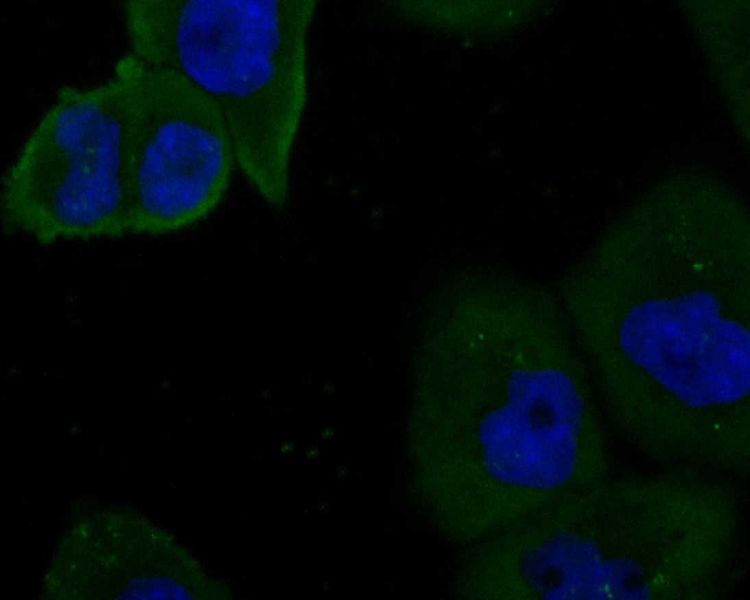 ICC staining of Kv1.4 in PANC-1 cells (green). Formalin fixed cells were permeabilized with 0.1% Triton X-100 in TBS for 10 minutes at room temperature and blocked with 1% Blocker BSA for 15 minutes at room temperature. Cells were probed with the primary antibody (ER1902-49, 1/200) for 1 hour at room temperature, washed with PBS. Alexa Fluor®488 Goat anti-Rabbit IgG was used as the secondary antibody at 1/100 dilution. The nuclear counter stain is DAPI (blue).