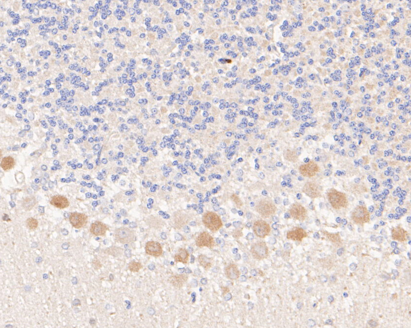 Immunohistochemical analysis of paraffin-embedded rat cerebellar  tissue using anti-Kv1.4 antibody. The section was pre-treated using heat mediated antigen retrieval with Tris-EDTA buffer (pH 8.0-8.4) for 20 minutes.The tissues were blocked in 5% BSA for 30 minutes at room temperature, washed with ddH2O and PBS, and then probed with the primary antibody (ER1902-49, 1/200) for 30 minutes at room temperature. The detection was performed using an HRP conjugated compact polymer system. DAB was used as the chromogen. Tissues were counterstained with hematoxylin and mounted with DPX.