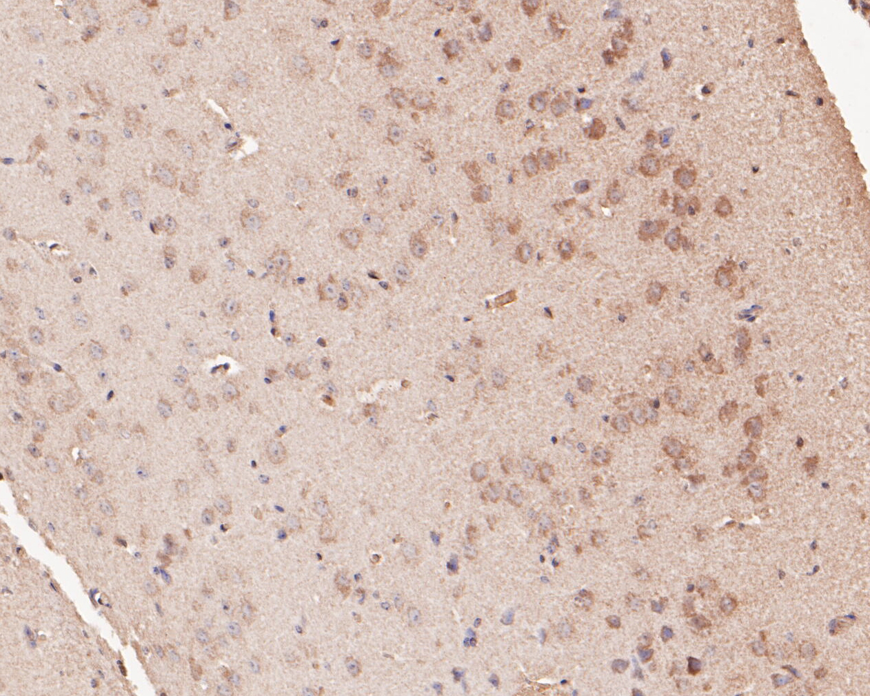 Immunohistochemical analysis of paraffin-embedded mouse brain tissue using anti-Kv1.4 antibody. The section was pre-treated using heat mediated antigen retrieval with Tris-EDTA buffer (pH 8.0-8.4) for 20 minutes.The tissues were blocked in 5% BSA for 30 minutes at room temperature, washed with ddH2O and PBS, and then probed with the primary antibody (ER1902-49, 1/200) for 30 minutes at room temperature. The detection was performed using an HRP conjugated compact polymer system. DAB was used as the chromogen. Tissues were counterstained with hematoxylin and mounted with DPX.