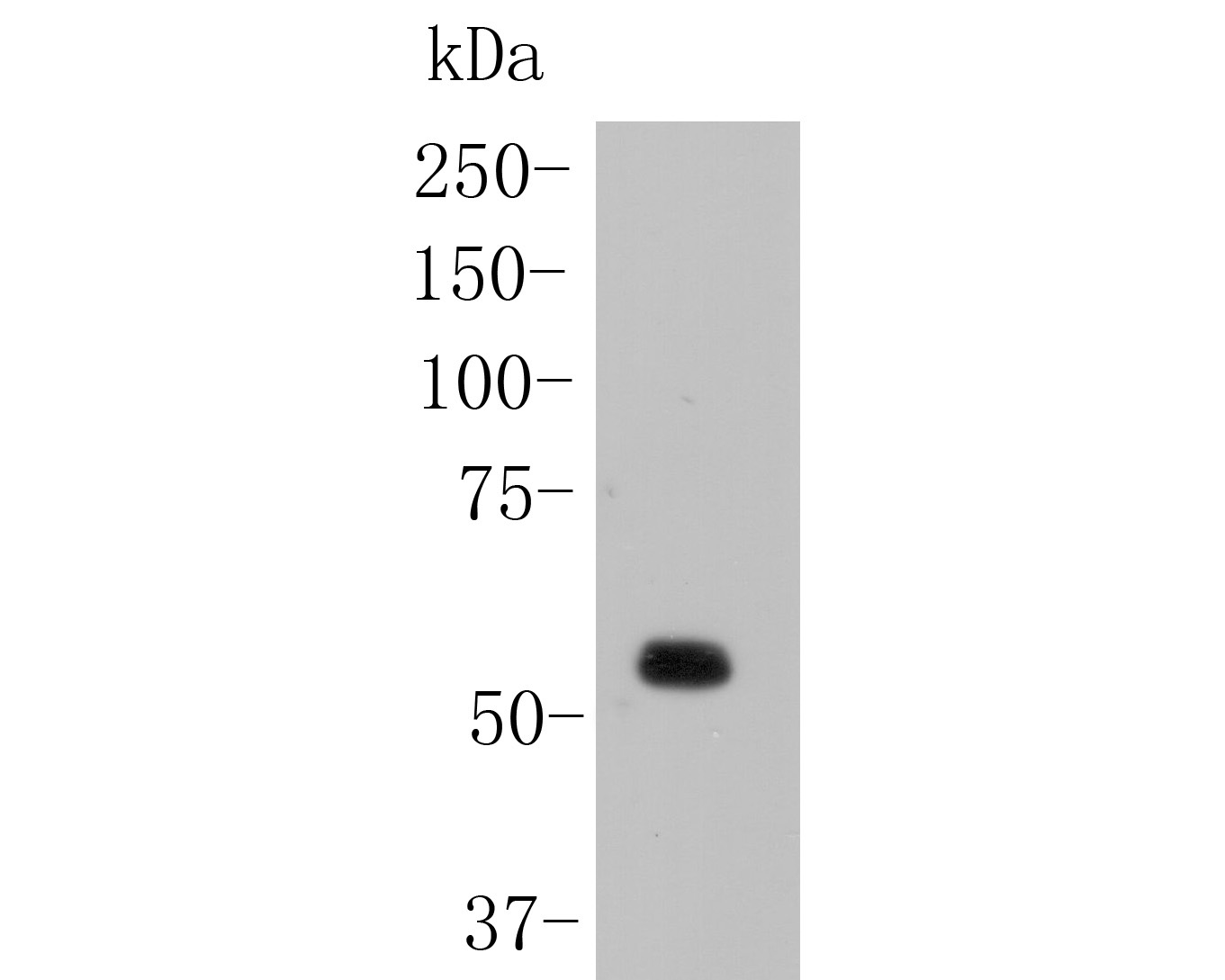 Western blot analysis of NHE-1 on rat skin lysates. Proteins were transferred to a PVDF membrane and blocked with 5% BSA in PBS for 1 hour at room temperature. The primary antibody (ER1902-51, 1/1000) was used in 5% BSA at room temperature for 2 hours. Goat Anti-Rabbit IgG - HRP Secondary Antibody (HA1001) at 1:5,000 dilution was used for 1 hour at room temperature.
