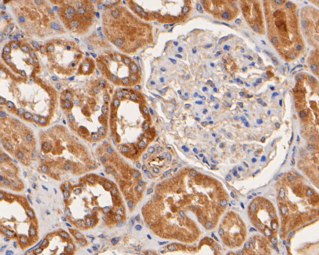 Immunohistochemical analysis of paraffin-embedded human kidney tissue using anti-NHE-1 antibody. The section was pre-treated using heat mediated antigen retrieval with Tris-EDTA buffer (pH 8.0-8.4) for 20 minutes.The tissues were blocked in 5% BSA for 30 minutes at room temperature, washed with ddH2O and PBS, and then probed with the primary antibody (ER1902-51, 1/50) for 30 minutes at room temperature. The detection was performed using an HRP conjugated compact polymer system. DAB was used as the chromogen. Tissues were counterstained with hematoxylin and mounted with DPX.