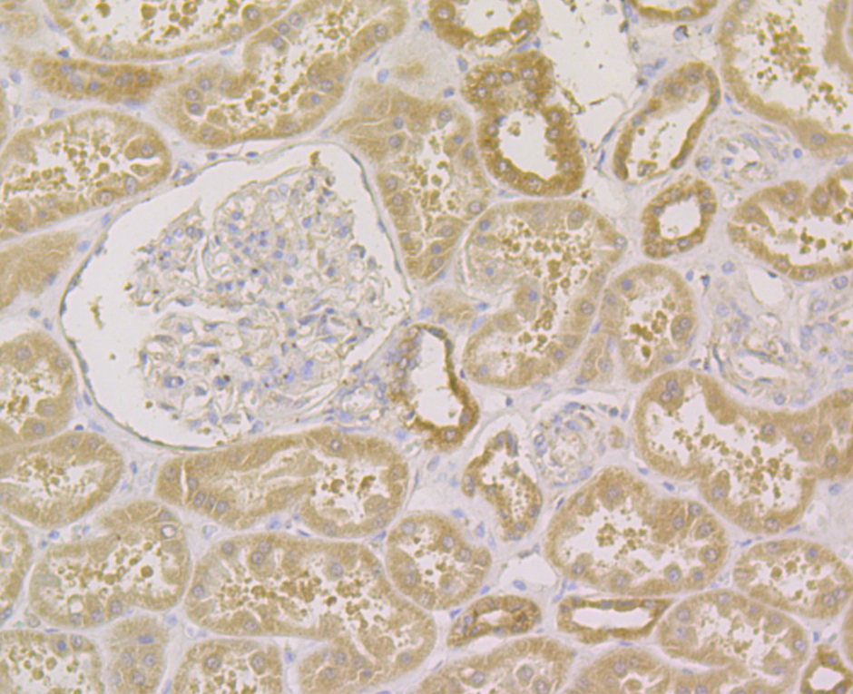 Immunohistochemical analysis of paraffin-embedded human kidney tissue using anti-LGR5/GPR49 antibody. The section was pre-treated using heat mediated antigen retrieval with Tris-EDTA buffer (pH 8.0-8.4) for 20 minutes.The tissues were blocked in 5% BSA for 30 minutes at room temperature, washed with ddH2O and PBS, and then probed with the antibody (ER1902-52) at 1/200 dilution, for 30 minutes at room temperature and detected using an HRP conjugated compact polymer system. DAB was used as the chrogen. Counter stained with hematoxylin and mounted with DPX.