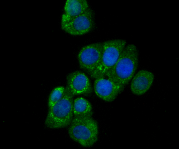 ICC staining of CEACAM6 in LOVO cells (green). Formalin fixed cells were permeabilized with 0.1% Triton X-100 in TBS for 10 minutes at room temperature and blocked with 1% Blocker BSA for 15 minutes at room temperature. Cells were probed with the primary antibody (ER1902-54, 1/200) for 1 hour at room temperature, washed with PBS. Alexa Fluor®488 Goat anti-Rabbit IgG was used as the secondary antibody at 1/100 dilution. The nuclear counter stain is DAPI (blue).