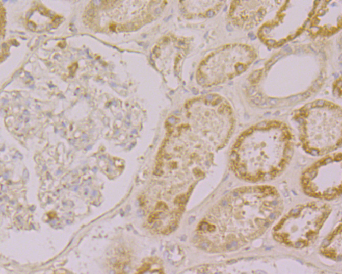 Immunohistochemical analysis of paraffin-embedded human kidney tissue using anti-Drebrin antibody. The section was pre-treated using heat mediated antigen retrieval with Tris-EDTA buffer (pH 8.0-8.4) for 20 minutes.The tissues were blocked in 5% BSA for 30 minutes at room temperature, washed with ddH2O and PBS, and then probed with the primary antibody (ER1902-55, 1/200) for 30 minutes at room temperature. The detection was performed using an HRP conjugated compact polymer system. DAB was used as the chromogen. Tissues were counterstained with hematoxylin and mounted with DPX.