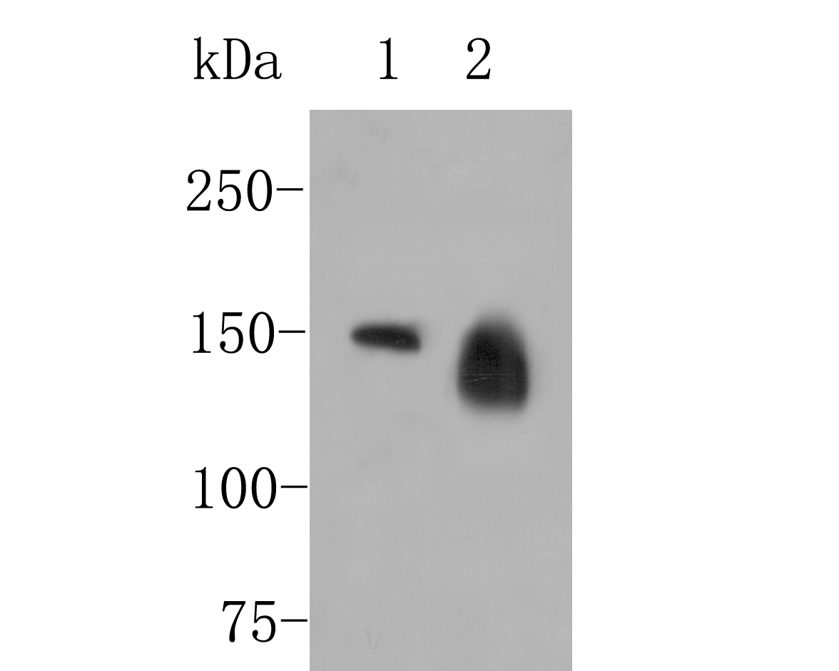 Western blot analysis of SynGAP on different lysates. Proteins were transferred to a PVDF membrane and blocked with 5% BSA in PBS for 1 hour at room temperature. The primary antibody (ER1902-57, 1/500) was used in 5% BSA at room temperature for 2 hours. Goat Anti-Rabbit IgG - HRP Secondary Antibody (HA1001) at 1:5,000 dilution was used for 1 hour at room temperature.<br />
Positive control: <br />
Lane 1: K562 cell lysate<br />
Lane 2: Mouse brain tissue lysate