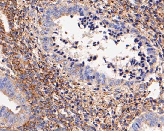 Immunohistochemical analysis of paraffin-embedded human terus tissue using anti-SynGAP antibody. The section was pre-treated using heat mediated antigen retrieval with Tris-EDTA buffer (pH 8.0-8.4) for 20 minutes.The tissues were blocked in 5% BSA for 30 minutes at room temperature, washed with ddH2O and PBS, and then probed with the primary antibody (ER1902-57, 1/100) for 30 minutes at room temperature. The detection was performed using an HRP conjugated compact polymer system. DAB was used as the chromogen. Tissues were counterstained with hematoxylin and mounted with DPX.