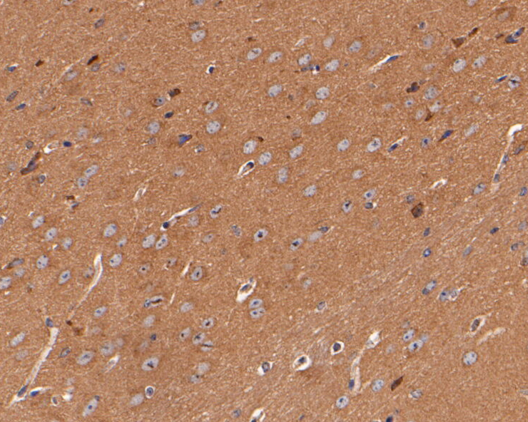 Immunohistochemical analysis of paraffin-embedded mouse brain tissue using anti-SynGAP antibody. The section was pre-treated using heat mediated antigen retrieval with Tris-EDTA buffer (pH 8.0-8.4) for 20 minutes.The tissues were blocked in 5% BSA for 30 minutes at room temperature, washed with ddH2O and PBS, and then probed with the primary antibody (ER1902-57, 1/100) for 30 minutes at room temperature. The detection was performed using an HRP conjugated compact polymer system. DAB was used as the chromogen. Tissues were counterstained with hematoxylin and mounted with DPX.