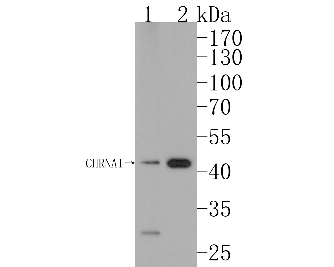 Western blot analysis of CHRNA1 on different lysates. Proteins were transferred to a PVDF membrane and blocked with 5% BSA in PBS for 1 hour at room temperature. The primary antibody (ER1902-58, 1/500) was used in 5% BSA at room temperature for 2 hours. Goat Anti-Rabbit IgG - HRP Secondary Antibody (HA1001) at 1:200,000 dilution was used for 1 hour at room temperature.<br />
Positive control: <br />
Lane 1: Rat heart tissue lysate<br />
Lane 2: Mouse heart tissue lysate