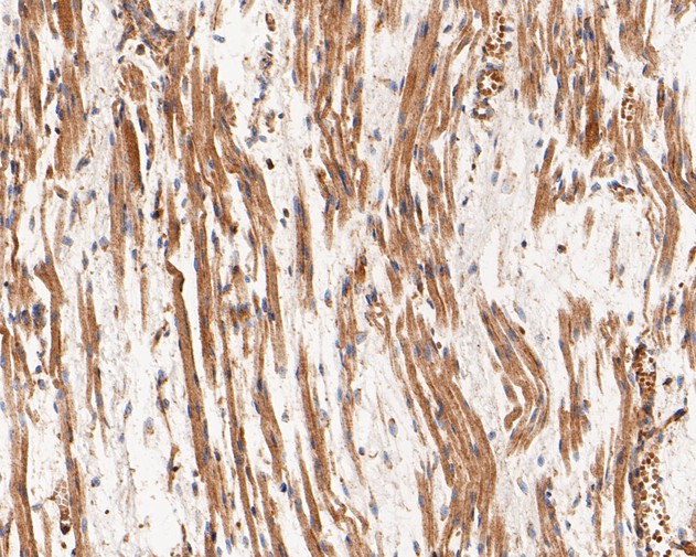 Immunohistochemical analysis of paraffin-embedded human fetal skeletal muscle tissue using anti-CHRNA1 antibody. The section was pre-treated using heat mediated antigen retrieval with Tris-EDTA buffer (pH 8.0-8.4) for 20 minutes.The tissues were blocked in 5% BSA for 30 minutes at room temperature, washed with ddH2O and PBS, and then probed with the primary antibody (ER1902-58, 1/200) for 30 minutes at room temperature. The detection was performed using an HRP conjugated compact polymer system. DAB was used as the chromogen. Tissues were counterstained with hematoxylin and mounted with DPX.