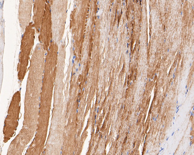 Immunohistochemical analysis of paraffin-embedded mouse skeletal muscle tissue using anti-CHRNA1 antibody. The section was pre-treated using heat mediated antigen retrieval with Tris-EDTA buffer (pH 8.0-8.4) for 20 minutes.The tissues were blocked in 5% BSA for 30 minutes at room temperature, washed with ddH2O and PBS, and then probed with the primary antibody (ER1902-58, 1/200) for 30 minutes at room temperature. The detection was performed using an HRP conjugated compact polymer system. DAB was used as the chromogen. Tissues were counterstained with hematoxylin and mounted with DPX.