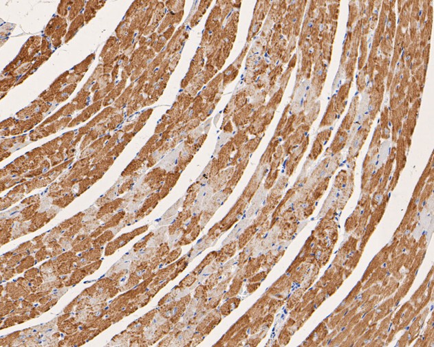 Immunohistochemical analysis of paraffin-embedded mouse heart tissue using anti-CHRNA1 antibody. The section was pre-treated using heat mediated antigen retrieval with Tris-EDTA buffer (pH 8.0-8.4) for 20 minutes.The tissues were blocked in 5% BSA for 30 minutes at room temperature, washed with ddH2O and PBS, and then probed with the primary antibody (ER1902-58, 1/200) for 30 minutes at room temperature. The detection was performed using an HRP conjugated compact polymer system. DAB was used as the chromogen. Tissues were counterstained with hematoxylin and mounted with DPX.