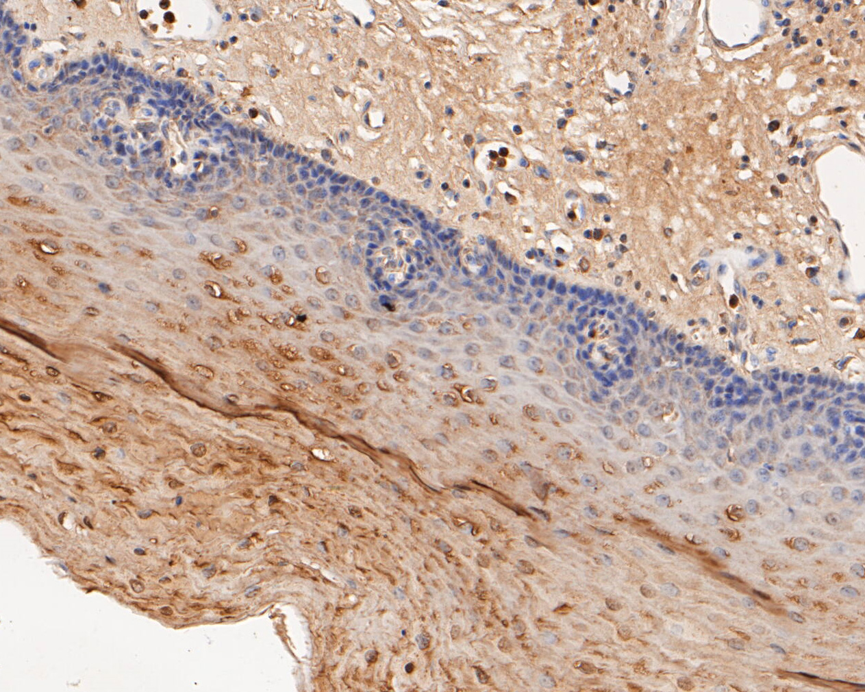 Immunohistochemical analysis of paraffin-embedded human esophagus tissue using anti-P2X2 antibody. The section was pre-treated using heat mediated antigen retrieval with Tris-EDTA buffer (pH 8.0-8.4) for 20 minutes.The tissues were blocked in 5% BSA for 30 minutes at room temperature, washed with ddH2O and PBS, and then probed with the primary antibody (ER1902-59, 1/50) for 30 minutes at room temperature. The detection was performed using an HRP conjugated compact polymer system. DAB was used as the chromogen. Tissues were counterstained with hematoxylin and mounted with DPX.