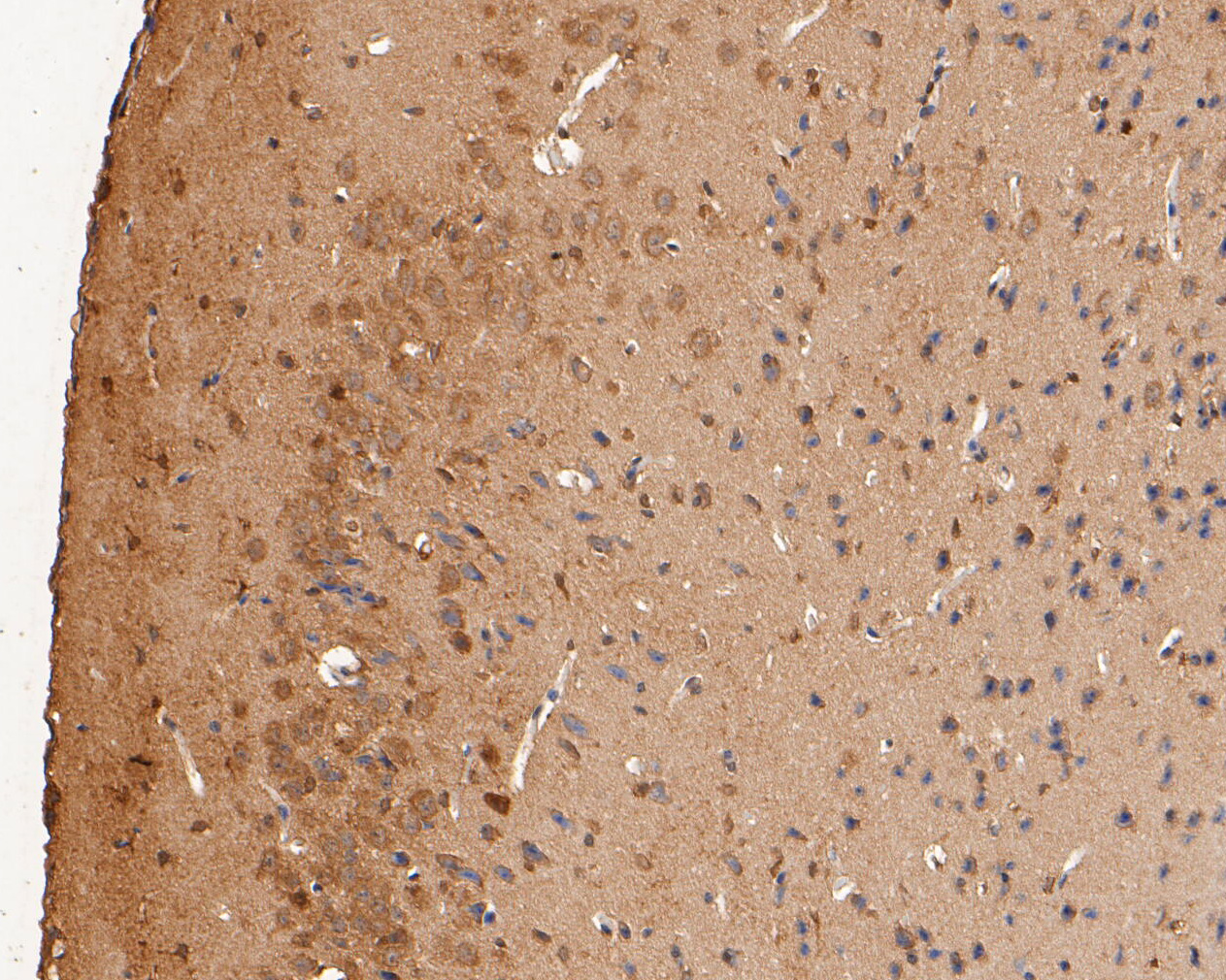 Immunohistochemical analysis of paraffin-embedded mouse brain tissue using anti-P2X2 antibody. The section was pre-treated using heat mediated antigen retrieval with Tris-EDTA buffer (pH 8.0-8.4) for 20 minutes.The tissues were blocked in 5% BSA for 30 minutes at room temperature, washed with ddH2O and PBS, and then probed with the primary antibody (ER1902-59, 1/50) for 30 minutes at room temperature. The detection was performed using an HRP conjugated compact polymer system. DAB was used as the chromogen. Tissues were counterstained with hematoxylin and mounted with DPX.