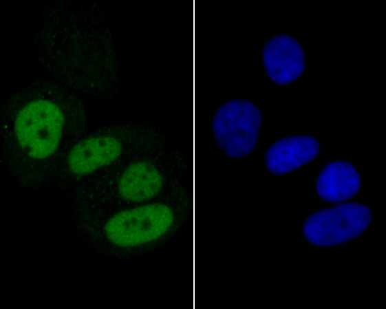 ICC staining of MCM7 in MCF-7 cells (green). Formalin fixed cells were permeabilized with 0.1% Triton X-100 in TBS for 10 minutes at room temperature and blocked with 1% Blocker BSA for 15 minutes at room temperature. Cells were probed with the primary antibody (ER1902-60, 1/200) for 1 hour at room temperature, washed with PBS. Alexa Fluor®488 Goat anti-Rabbit IgG was used as the secondary antibody at 1/100 dilution. The nuclear counter stain is DAPI (blue).