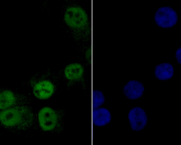 ICC staining of MCM7 in MG-63 cells (green). Formalin fixed cells were permeabilized with 0.1% Triton X-100 in TBS for 10 minutes at room temperature and blocked with 1% Blocker BSA for 15 minutes at room temperature. Cells were probed with the primary antibody (ER1902-60, 1/200) for 1 hour at room temperature, washed with PBS. Alexa Fluor®488 Goat anti-Rabbit IgG was used as the secondary antibody at 1/100 dilution. The nuclear counter stain is DAPI (blue).