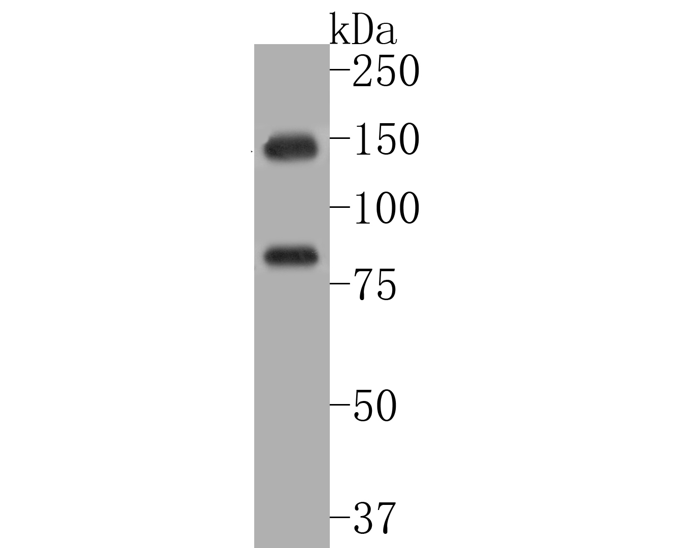 Western blot analysis of DNMT3A on Hela cell lysates. Proteins were transferred to a PVDF membrane and blocked with 5% BSA in PBS for 1 hour at room temperature. The primary antibody (ER1902-62, 1/500) was used in 5% BSA at room temperature for 2 hours. Goat Anti-Rabbit IgG - HRP Secondary Antibody (HA1001) at 1:200,000 dilution was used for 1 hour at room temperature.