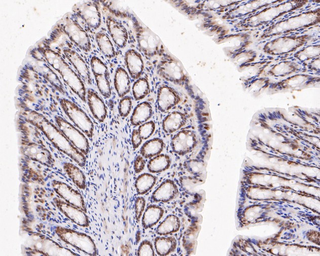 Immunohistochemical analysis of paraffin-embedded rat large intestine tissue using anti-DNMT3A antibody. The section was pre-treated using heat mediated antigen retrieval with sodium citrate buffer (pH 6.0) for 20 minutes. The tissues were blocked in 5% BSA for 30 minutes at room temperature, washed with ddH2O and PBS, and then probed with the primary antibody (ER1902-62, 1/200)  for 30 minutes at room temperature. The detection was performed using an HRP conjugated compact polymer system. DAB was used as the chromogen. Tissues were counterstained with hematoxylin and mounted with DPX.
