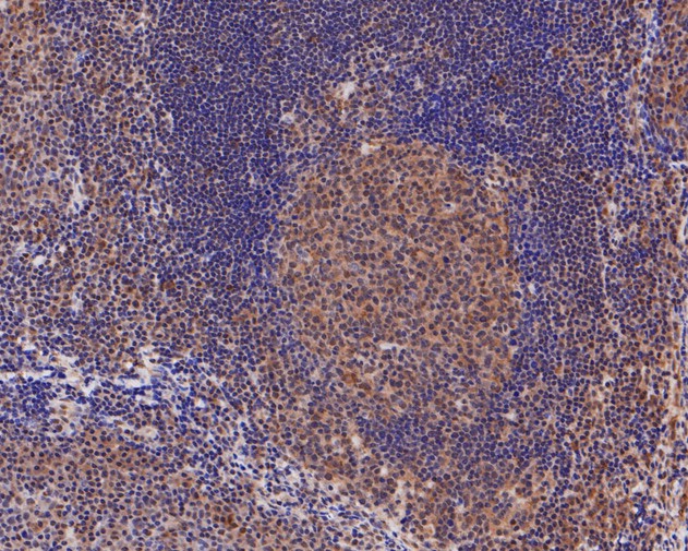 Immunohistochemical analysis of paraffin-embedded human tonsil tissue using anti-DNMT3A antibody. The section was pre-treated using heat mediated antigen retrieval with sodium citrate buffer (pH 6.0) for 20 minutes. The tissues were blocked in 5% BSA for 30 minutes at room temperature, washed with ddH2O and PBS, and then probed with the primary antibody (ER1902-62, 1/200)  for 30 minutes at room temperature. The detection was performed using an HRP conjugated compact polymer system. DAB was used as the chromogen. Tissues were counterstained with hematoxylin and mounted with DPX.