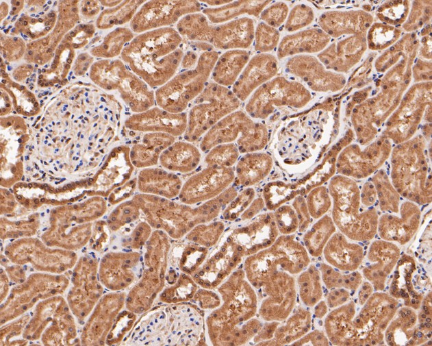 Immunohistochemical analysis of paraffin-embedded human kidney tissue using anti-DNMT3A antibody. The section was pre-treated using heat mediated antigen retrieval with sodium citrate buffer (pH 6.0) for 20 minutes. The tissues were blocked in 5% BSA for 30 minutes at room temperature, washed with ddH2O and PBS, and then probed with the primary antibody (ER1902-62, 1/200)  for 30 minutes at room temperature. The detection was performed using an HRP conjugated compact polymer system. DAB was used as the chromogen. Tissues were counterstained with hematoxylin and mounted with DPX.