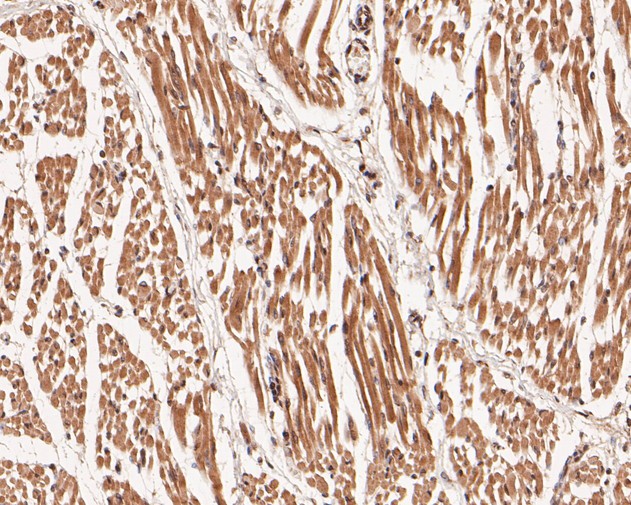 Immunohistochemical analysis of paraffin-embedded human fetal skeletal muscle tissue using anti-DNMT3A antibody. The section was pre-treated using heat mediated antigen retrieval with sodium citrate buffer (pH 6.0) for 20 minutes. The tissues were blocked in 5% BSA for 30 minutes at room temperature, washed with ddH2O and PBS, and then probed with the primary antibody (ER1902-62, 1/200)  for 30 minutes at room temperature. The detection was performed using an HRP conjugated compact polymer system. DAB was used as the chromogen. Tissues were counterstained with hematoxylin and mounted with DPX.