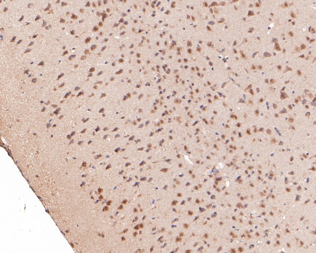 Immunohistochemical analysis of paraffin-embedded mouse brain tissue using anti-DNMT3A antibody. The section was pre-treated using heat mediated antigen retrieval with sodium citrate buffer (pH 6.0) for 20 minutes. The tissues were blocked in 5% BSA for 30 minutes at room temperature, washed with ddH2O and PBS, and then probed with the primary antibody (ER1902-62, 1/200)  for 30 minutes at room temperature. The detection was performed using an HRP conjugated compact polymer system. DAB was used as the chromogen. Tissues were counterstained with hematoxylin and mounted with DPX.
