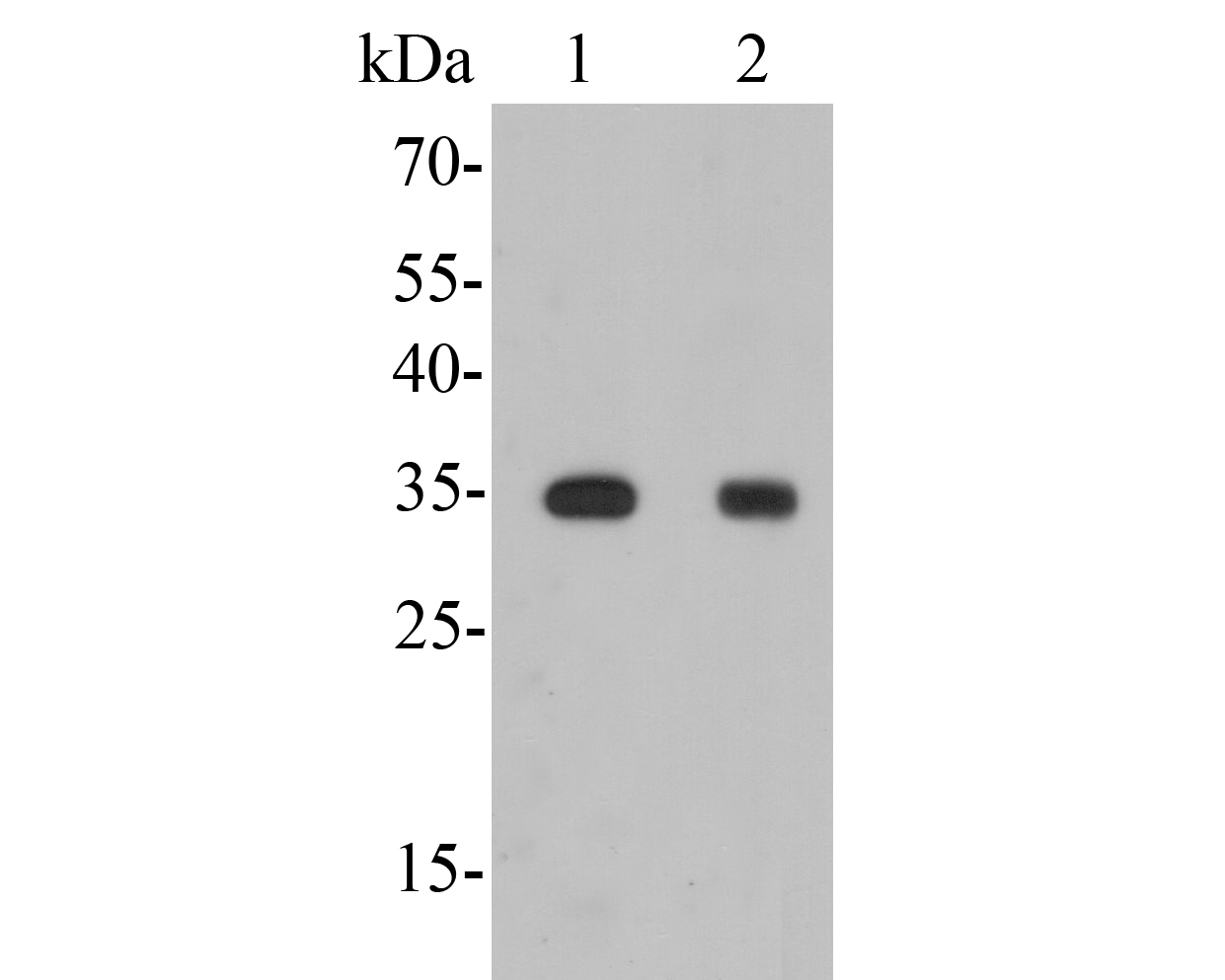 Western blot analysis of GAL4 on different lysates. Proteins were transferred to a PVDF membrane and blocked with 5% BSA in PBS for 1 hour at room temperature. The primary antibody (ER1902-63, 1/500) was used in 5% BSA at room temperature for 2 hours. Goat Anti-Rabbit IgG - HRP Secondary Antibody (HA1001) at 1:5,000 dilution was used for 1 hour at room temperature.<br />
Positive control: <br />
Lane 1: Human small intestine tissue lysate<br />
Lane 2: Mouse colon tissue lysate