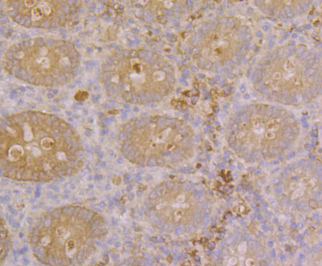 Immunohistochemical analysis of paraffin-embedded human appendix tissue using anti-GAL4 antibody. The section was pre-treated using heat mediated antigen retrieval with Tris-EDTA buffer (pH 8.0-8.4) for 20 minutes.The tissues were blocked in 5% BSA for 30 minutes at room temperature, washed with ddH2O and PBS, and then probed with the primary antibody (ER1902-63, 1/200) for 30 minutes at room temperature. The detection was performed using an HRP conjugated compact polymer system. DAB was used as the chromogen. Tissues were counterstained with hematoxylin and mounted with DPX.