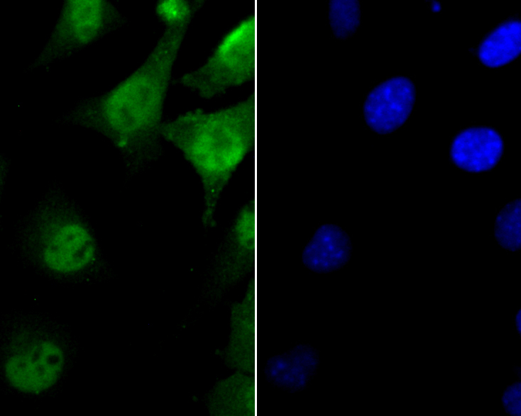 ICC staining of FEN1 in SHSY5Y cells (green). Formalin fixed cells were permeabilized with 0.1% Triton X-100 in TBS for 10 minutes at room temperature and blocked with 1% Blocker BSA for 15 minutes at room temperature. Cells were probed with the primary antibody (ER1902-64, 1/200) for 1 hour at room temperature, washed with PBS. Alexa Fluor®488 Goat anti-Rabbit IgG was used as the secondary antibody at 1/100 dilution. The nuclear counter stain is DAPI (blue).