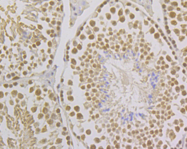Immunohistochemical analysis of paraffin-embedded mouse testis tissue using anti-FEN1 antibody. The section was pre-treated using heat mediated antigen retrieval with sodium citrate buffer (pH 6.0) for 20 minutes. The tissues were blocked in 5% BSA for 30 minutes at room temperature, washed with ddH2O and PBS, and then probed with the primary antibody (ER1902-64, 1/100)  for 30 minutes at room temperature. The detection was performed using an HRP conjugated compact polymer system. DAB was used as the chromogen. Tissues were counterstained with hematoxylin and mounted with DPX.