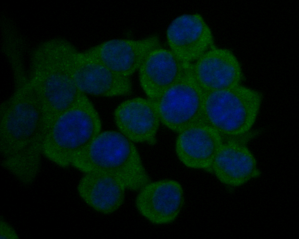 ICC staining of Kidins220 in N2A cells (green). Formalin fixed cells were permeabilized with 0.1% Triton X-100 in TBS for 10 minutes at room temperature and blocked with 1% Blocker BSA for 15 minutes at room temperature. Cells were probed with the primary antibody (ER1902-65, 1/200) for 1 hour at room temperature, washed with PBS. Alexa Fluor®488 Goat anti-Rabbit IgG was used as the secondary antibody at 1/1,000 dilution. The nuclear counter stain is DAPI (blue).