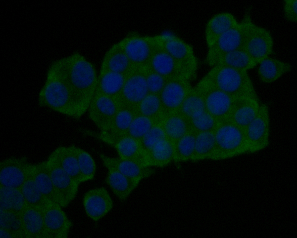 ICC staining of Kidins220 in PC-12 cells (green). Formalin fixed cells were permeabilized with 0.1% Triton X-100 in TBS for 10 minutes at room temperature and blocked with 1% Blocker BSA for 15 minutes at room temperature. Cells were probed with the primary antibody (ER1902-65, 1/200) for 1 hour at room temperature, washed with PBS. Alexa Fluor®488 Goat anti-Rabbit IgG was used as the secondary antibody at 1/1,000 dilution. The nuclear counter stain is DAPI (blue).